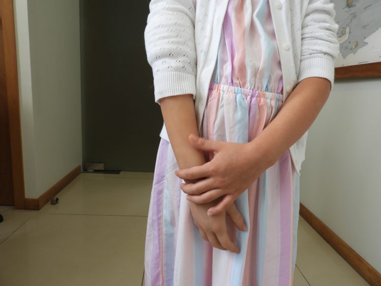 prosthetic arm girl