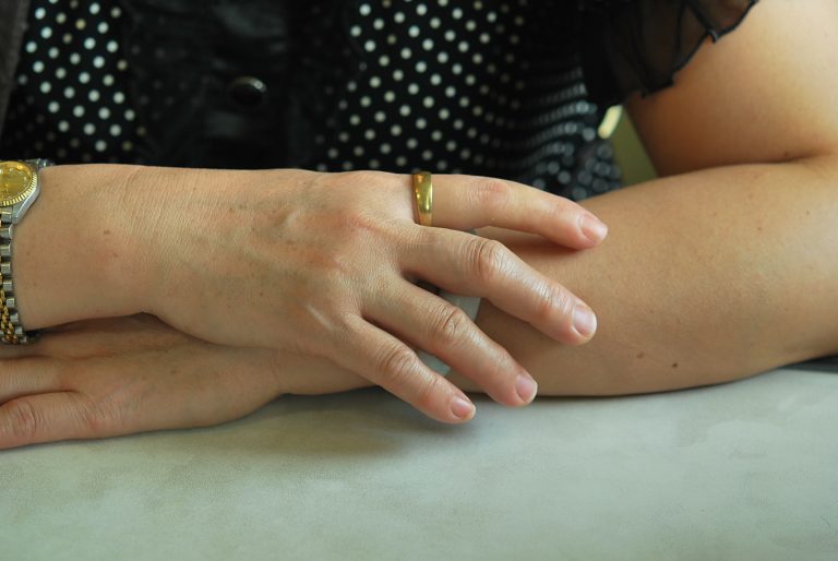 index finger prostheses