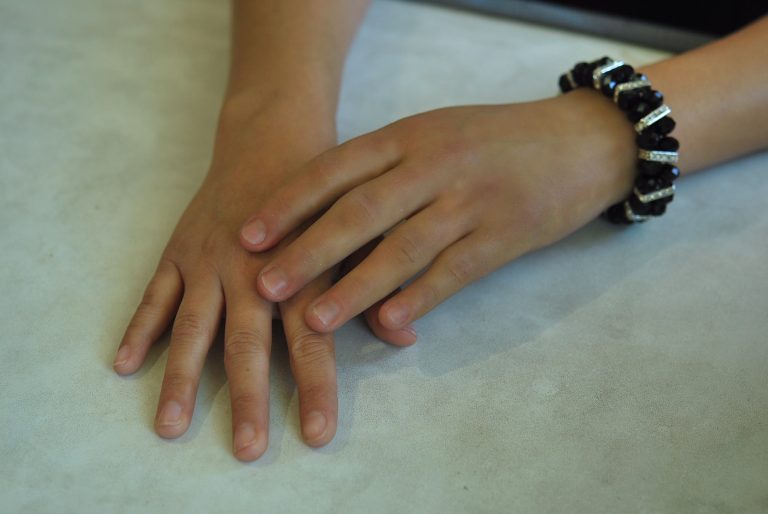 prosthetic hand