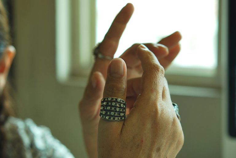 prosthetic thumb