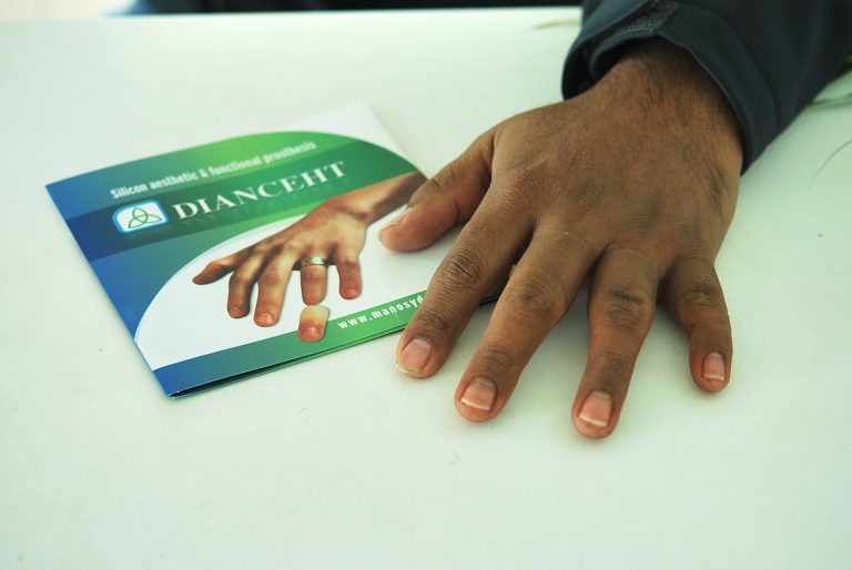 finger prostheses