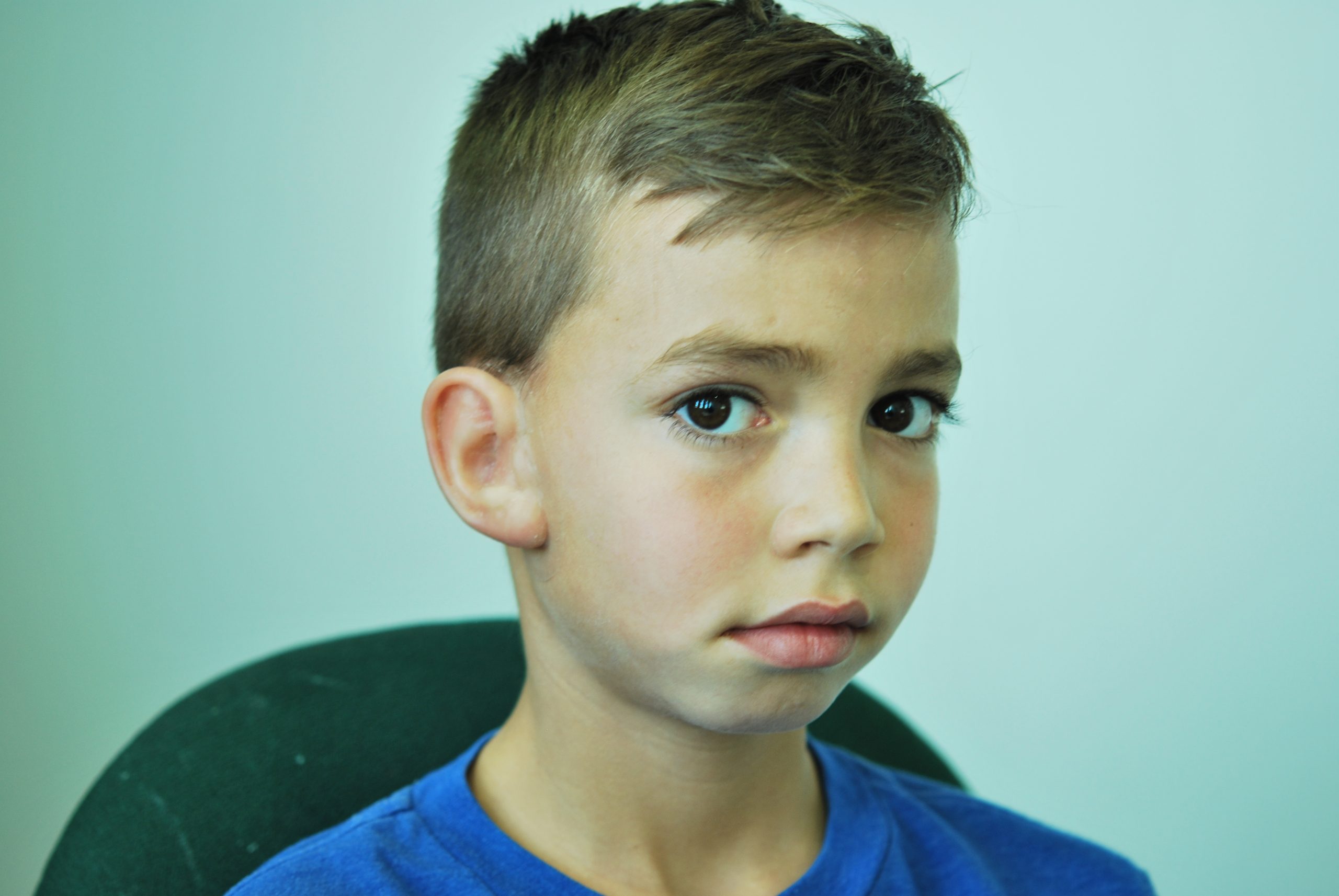 ear prosthetics