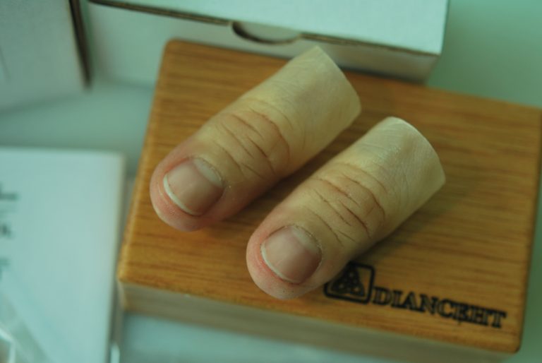 prosthetic thumbs