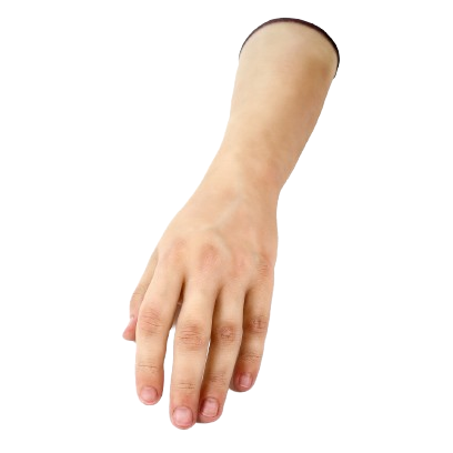 Arm