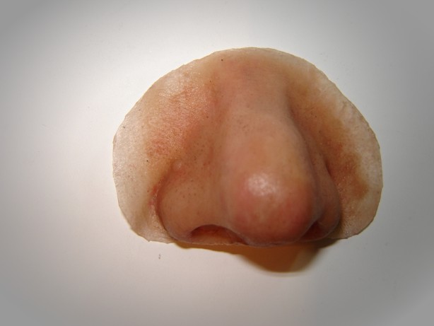 nose prosthesis