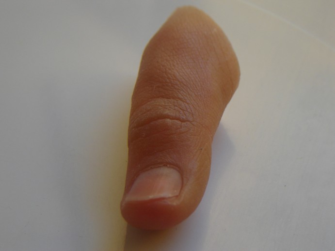 thumb prostheses