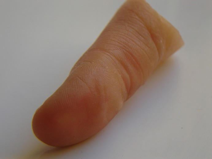 thumb prosthesis