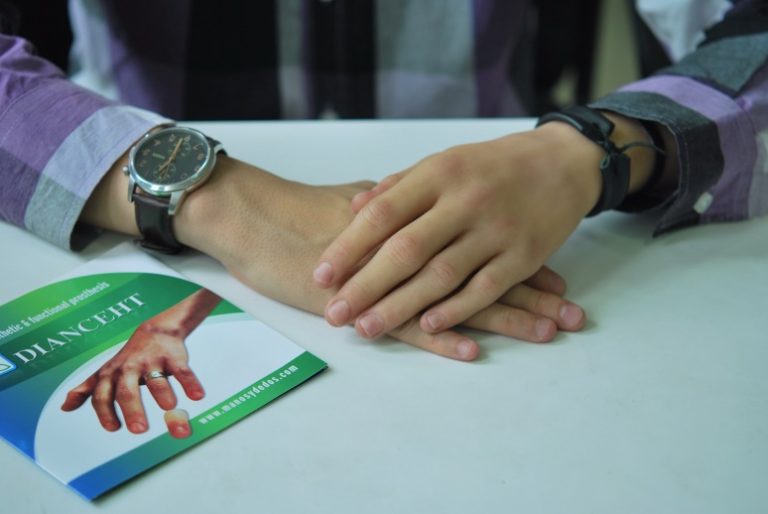 realistic hand prosthesis