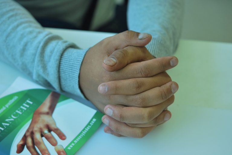 finger prostheses