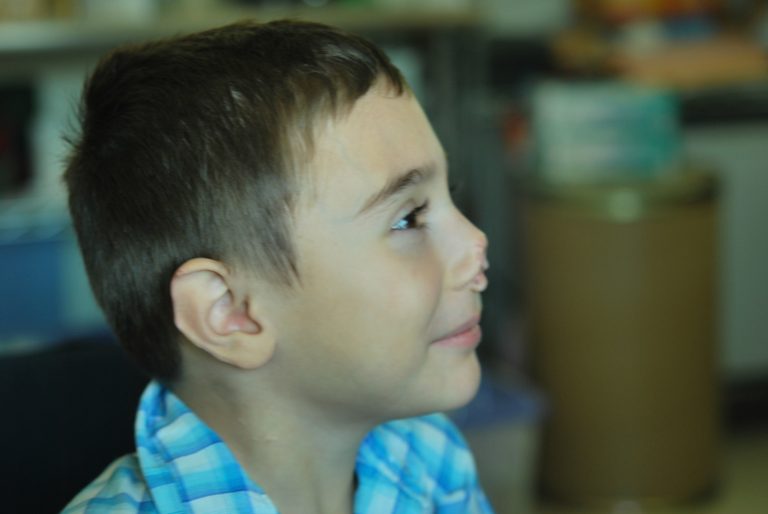 nose prosthetics