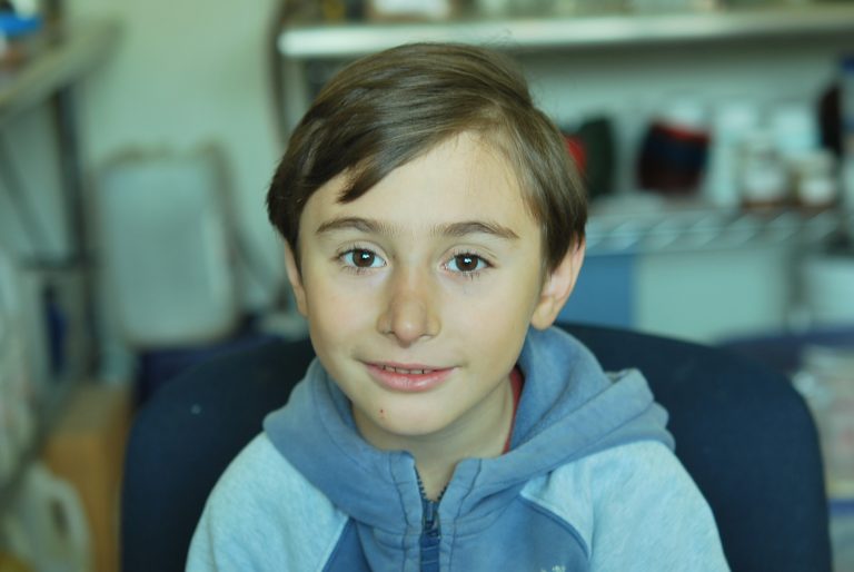 prosthetic nose